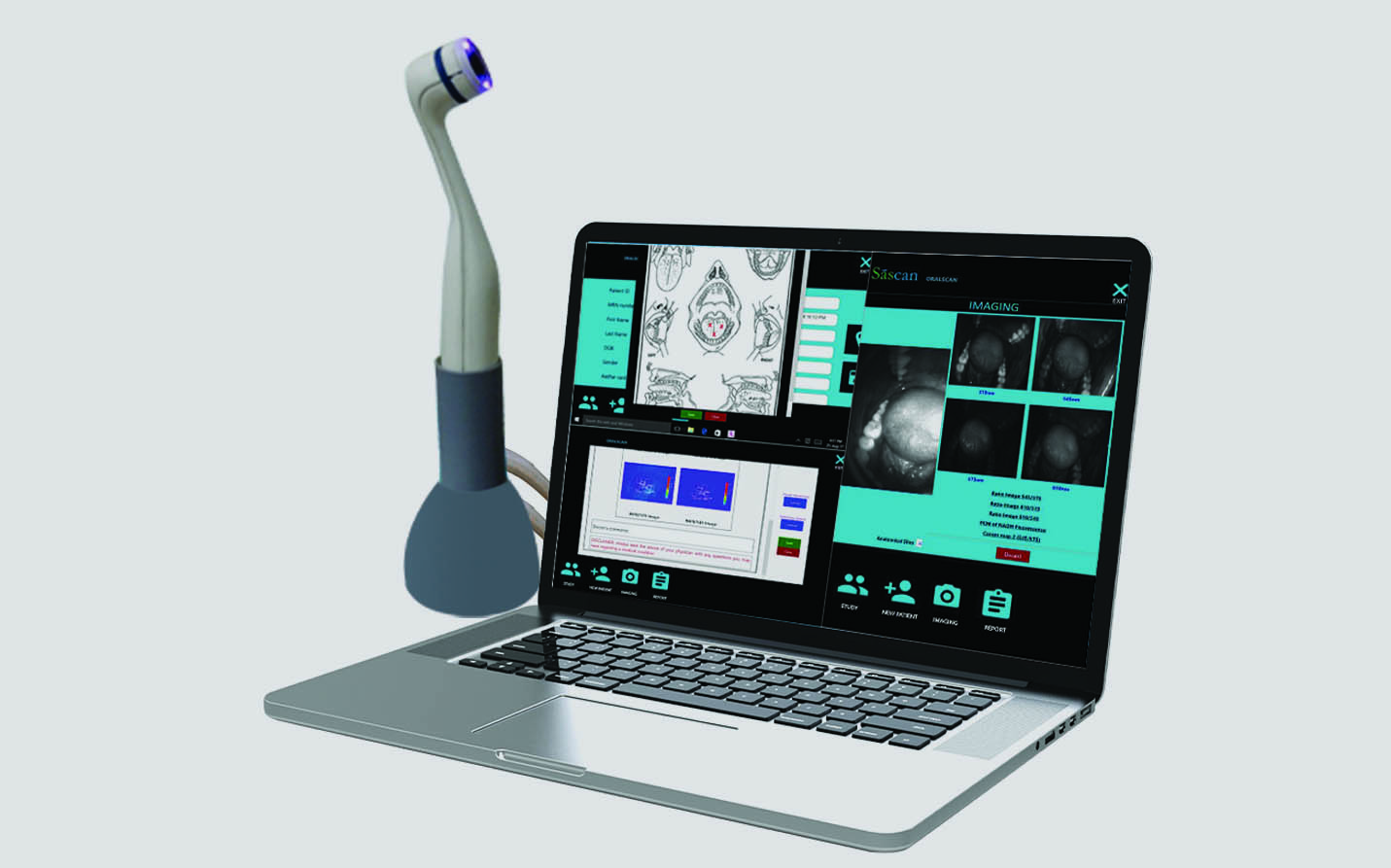 Oralscan device